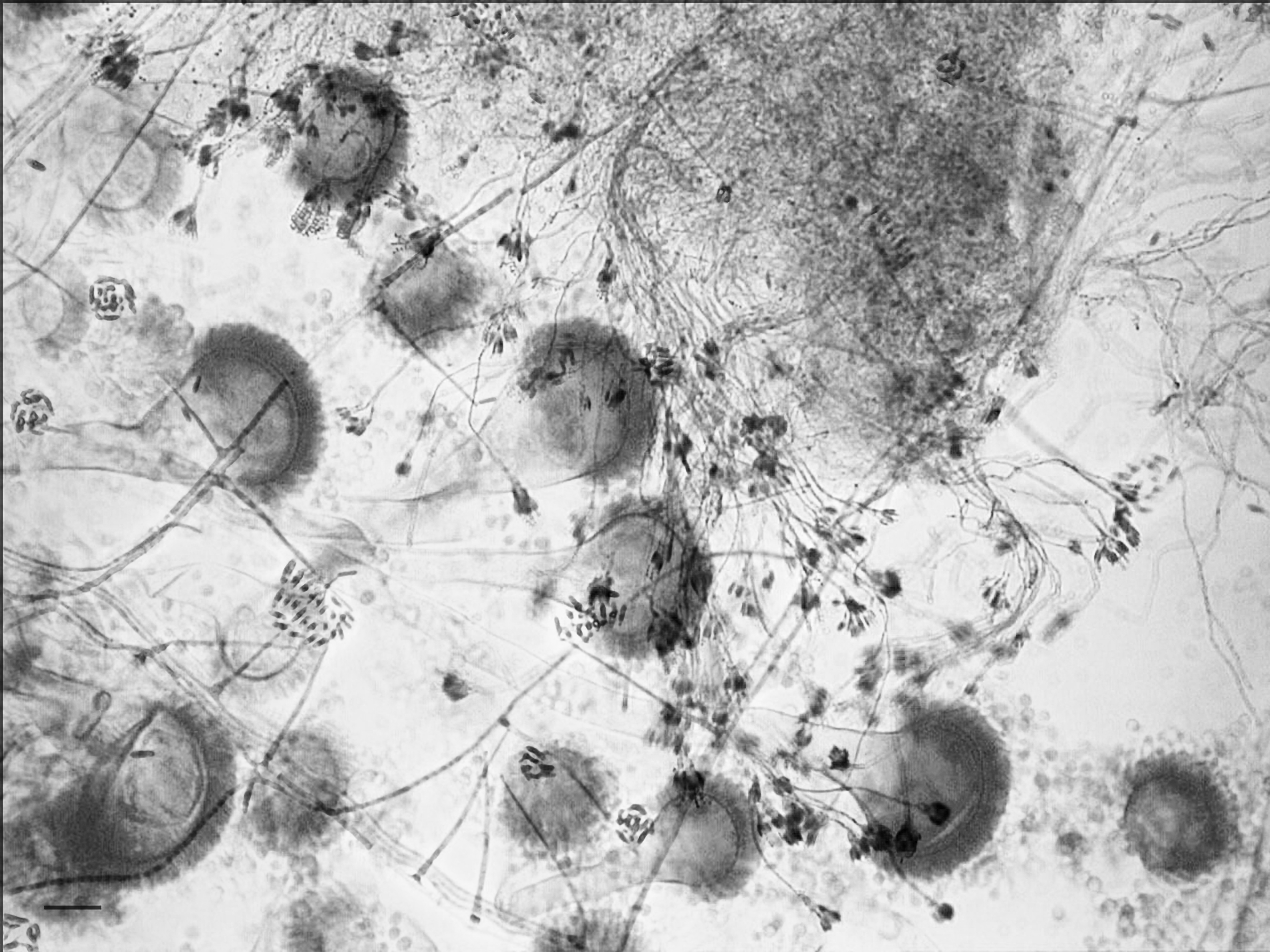 A collage of three microscopic views of moulds: Rhizopus, Penicillium, and Aspergillus.